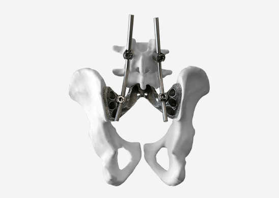 Rapid Prototyping for Medical Device Development